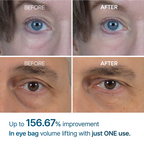 Eyephalt eyebag cream